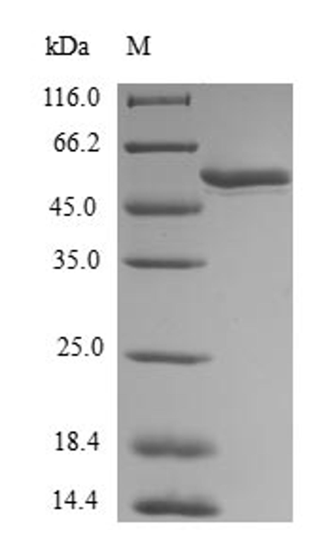 (Tris-Glycine gel) Discontinuous SDS-PAGE (reduced) with 5% enrichment gel and 15% separation gel.