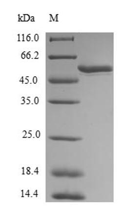 (Tris-Glycine gel) Discontinuous SDS-PAGE (reduced) with 5% enrichment gel and 15% separation gel.