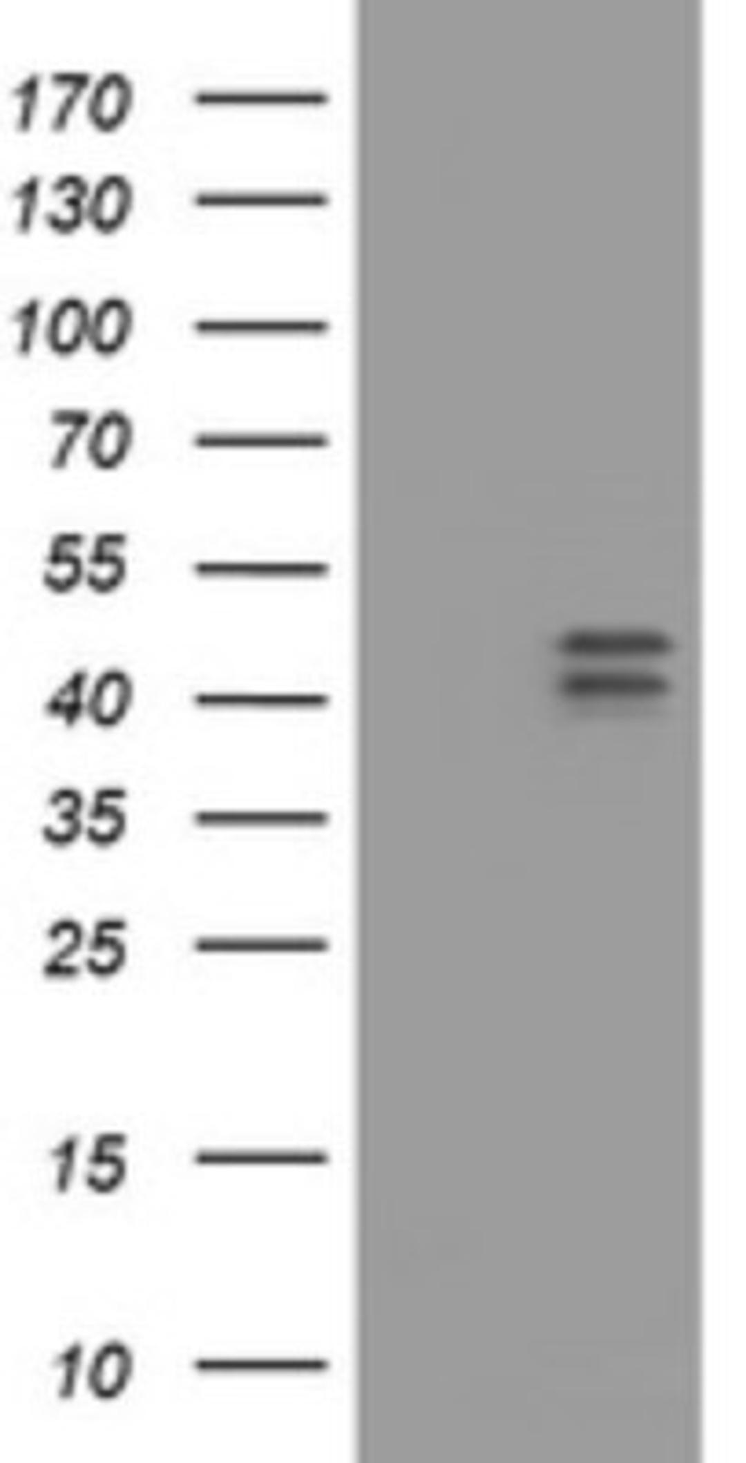 Western Blot: HOXD10 Antibody (1D11) [NBP2-45744] - Analysis of HEK293T cells were transfected with the pCMV6-ENTRY control (Left lane) or pCMV6-ENTRY HOXD10.