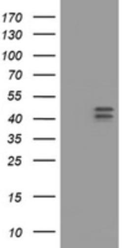 Western Blot: HOXD10 Antibody (1D11) [NBP2-45744] - Analysis of HEK293T cells were transfected with the pCMV6-ENTRY control (Left lane) or pCMV6-ENTRY HOXD10.