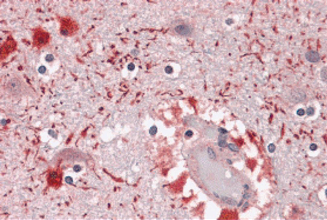 Immunohistochemistry of PIWI-L2 in human brain tissue with PIWI-L2 antibody at 5 μg/mL.