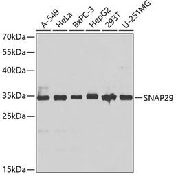 Western blot - SNAP29 antibody (A4290)