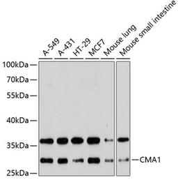 Western blot - CMA1 antibody (A5668)