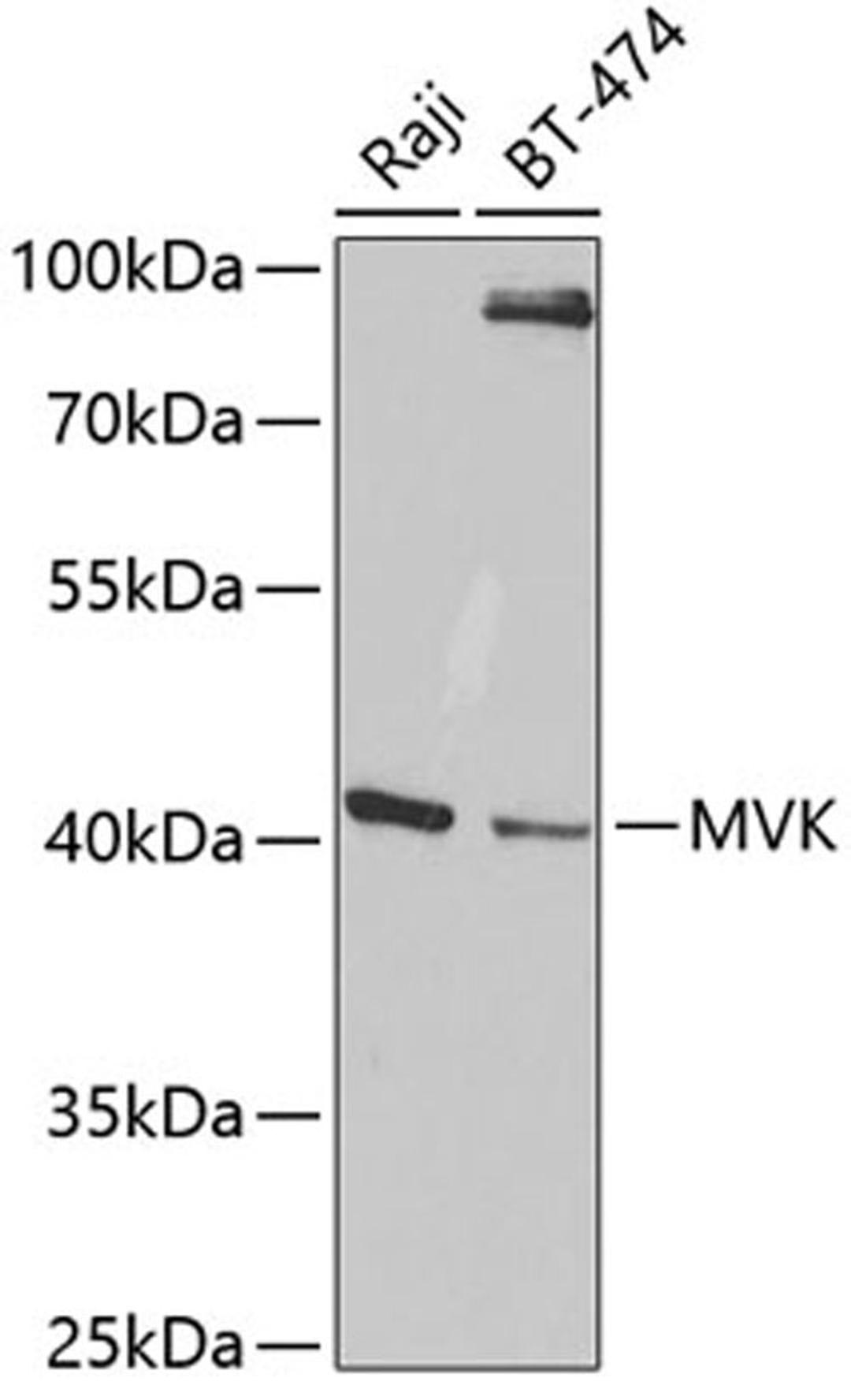 Western blot - MVK antibody (A5354)