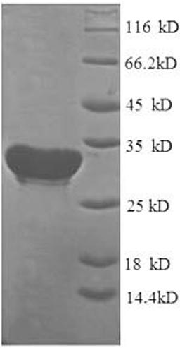 (Tris-Glycine gel) Discontinuous SDS-PAGE (reduced) with 5% enrichment gel and 15% separation gel.