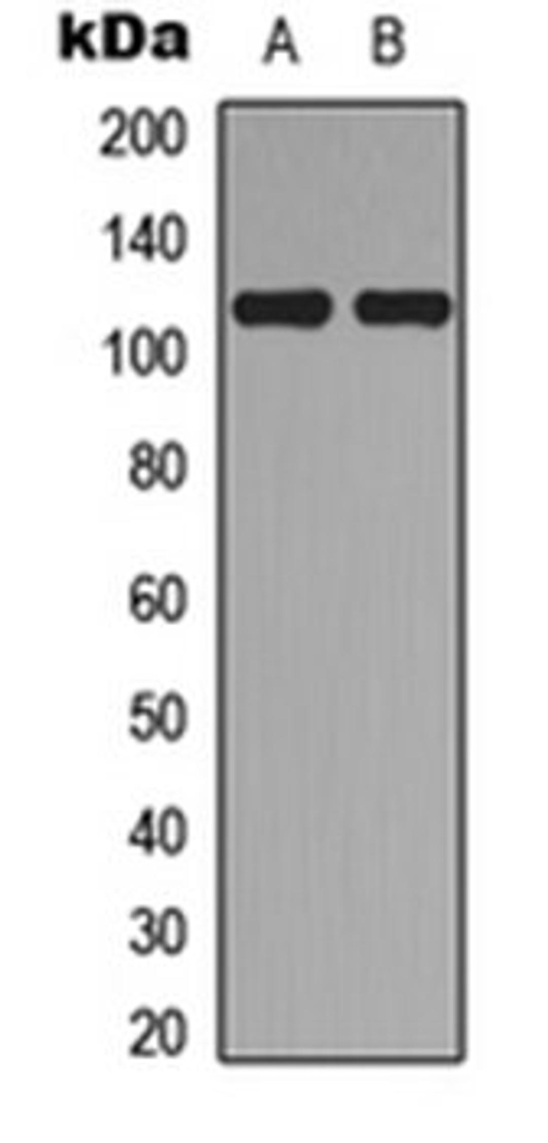 Western blot analysis of A549 (Lane 1), MCF7 (Lane 2) whole cell lysates using Topoisomerase 3 alpha antibody