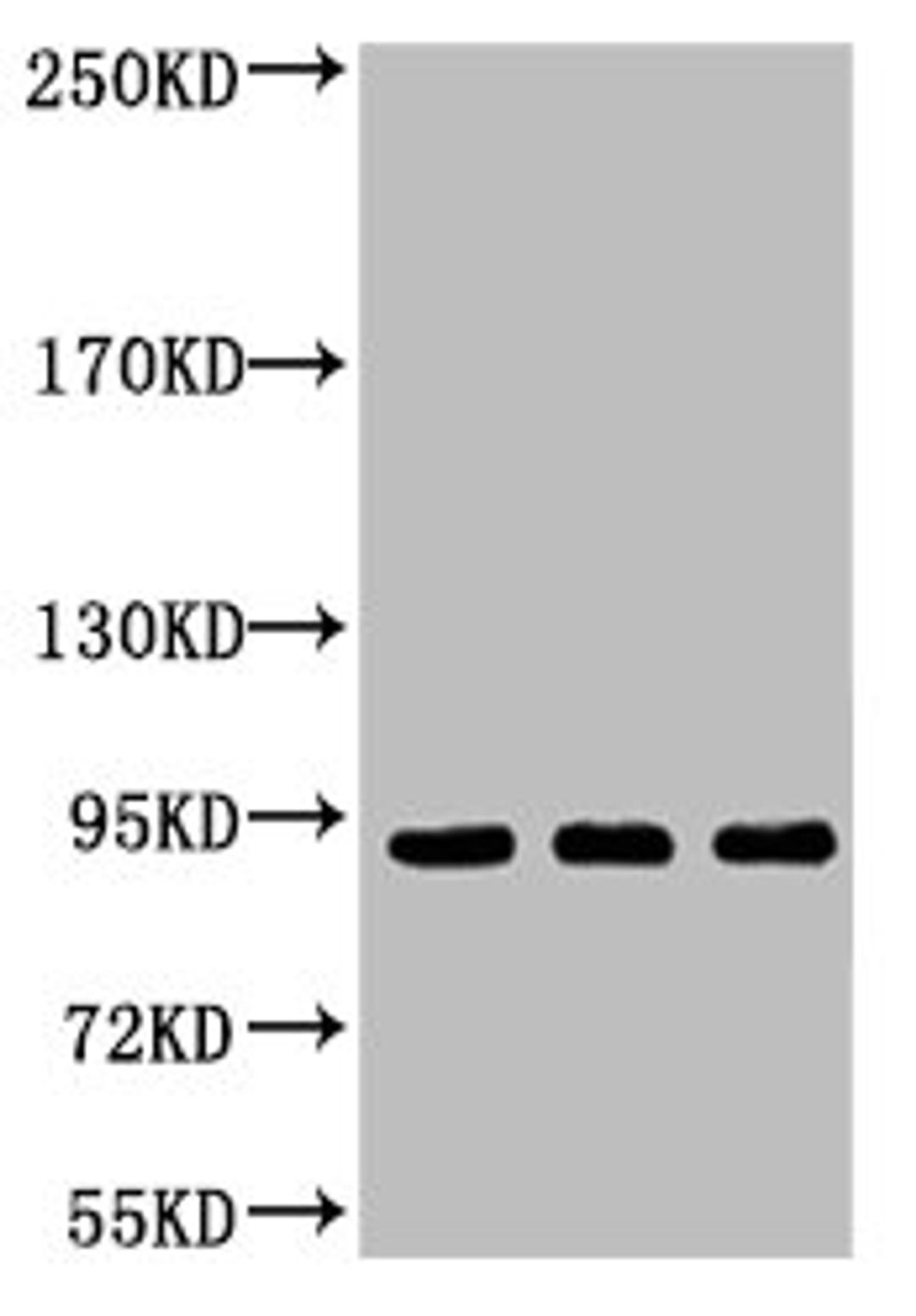 Western blot analysis of 1) Hela, 2) Jurkat, 3) HepG2, diluted at 1:2000
