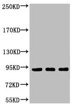 Western blot analysis of 1) Hela, 2) Jurkat, 3) HepG2, diluted at 1:2000