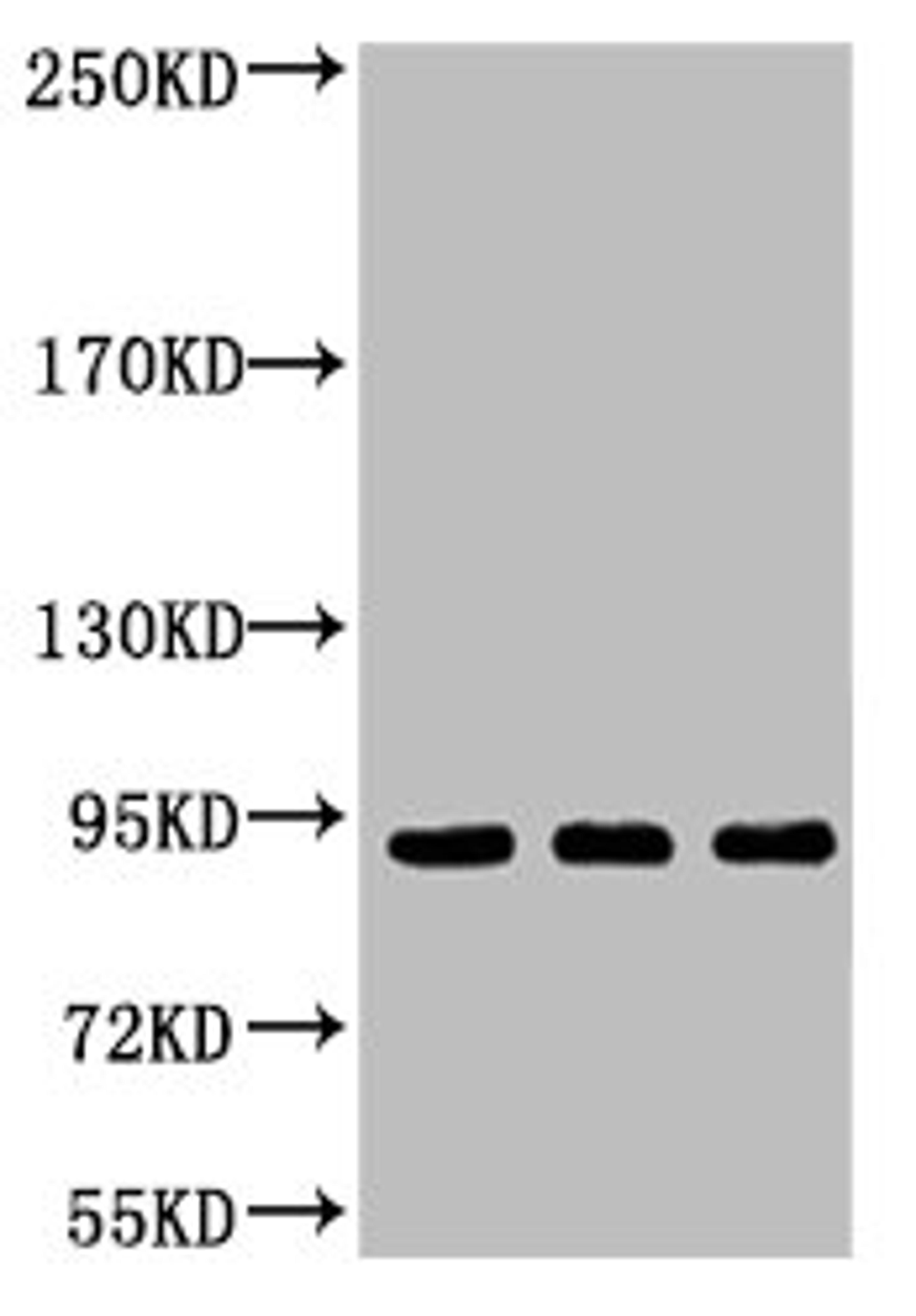 Western blot analysis of 1) Hela, 2) Jurkat, 3) HepG2, diluted at 1:2000