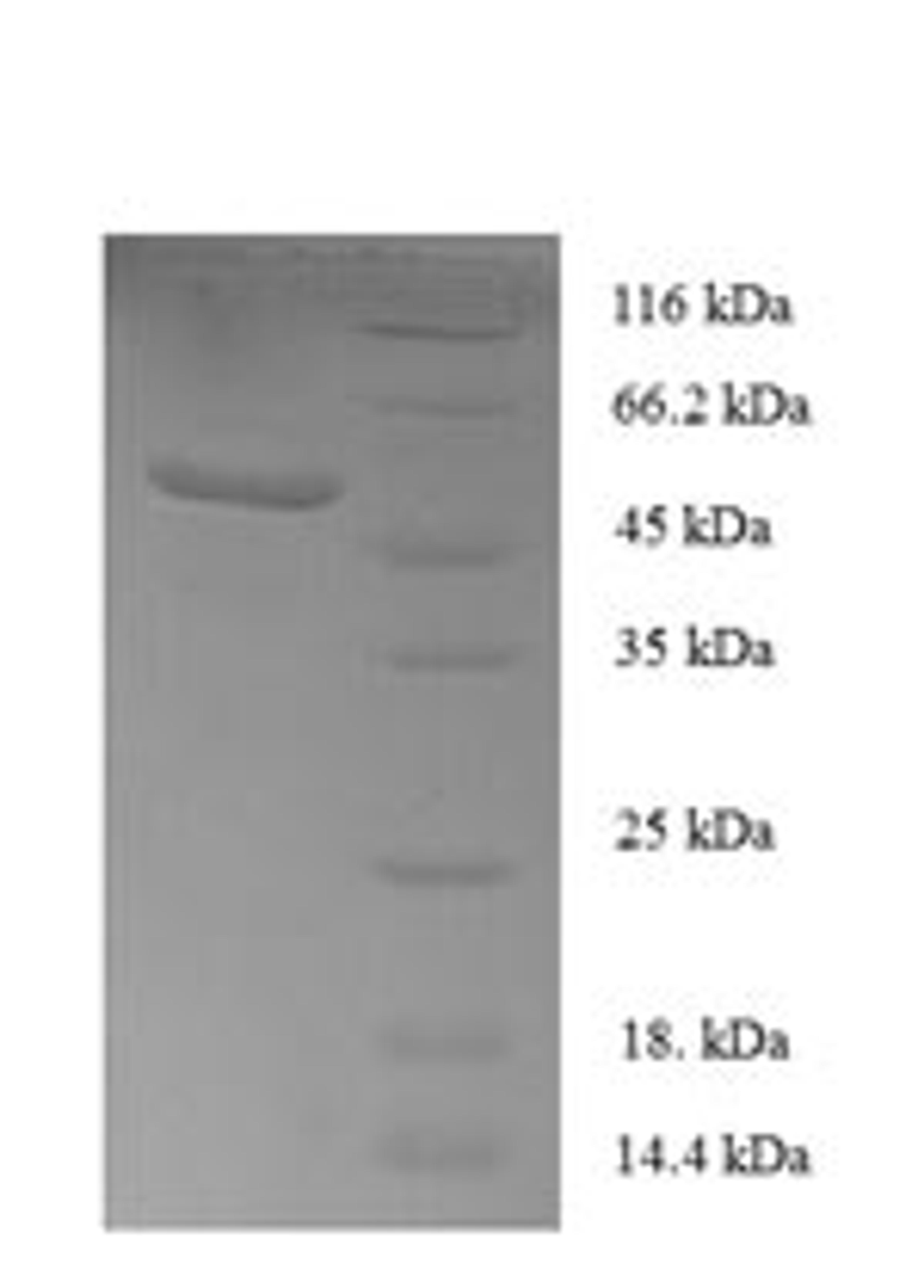 (Tris-Glycine gel) Discontinuous SDS-PAGE (reduced) with 5% enrichment gel and 15% separation gel.