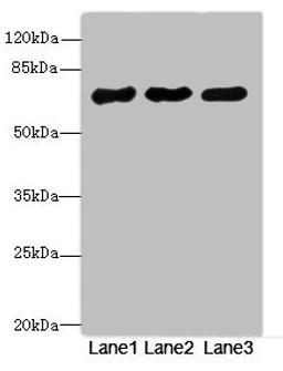 Western blot. All lanes: PPM1Dantibody at 2.66ug/ml. Lane 1: Rat gonadal tissue. Lane 2: U87 whole cell lysate. Lane 3: 293T whole cell lysate. Secondary. Goat polyclonal to rabbit IgG at 1/10000 dilution. Predicted band size: 67, 48 kDa. Observed band size: 67 kDa. 