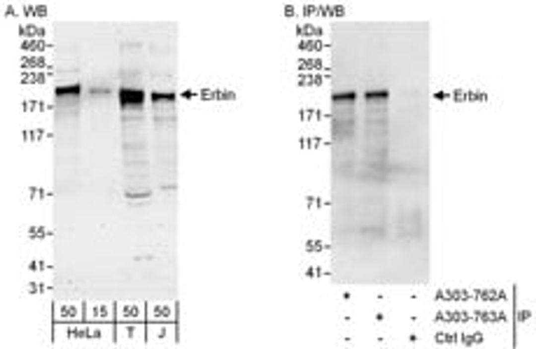 Detection of human Erbin by western blot and immunoprecipitation.