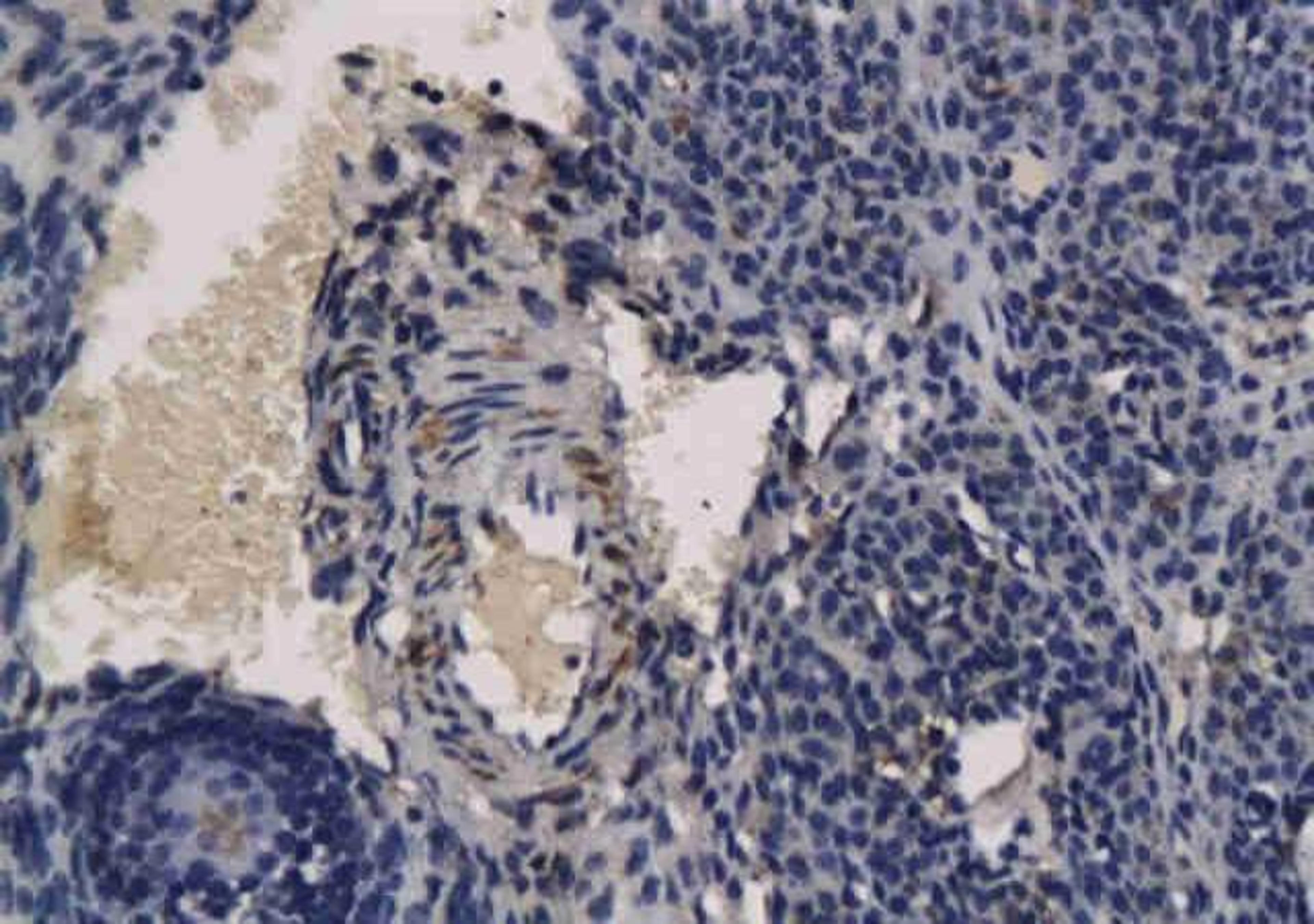 Immunohistochemical analysis of paraffin-embedded rat ovarian using Apelin Receptor antibody.