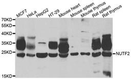 Western blot analysis of extracts of various cell lines using NUTF2 antibody