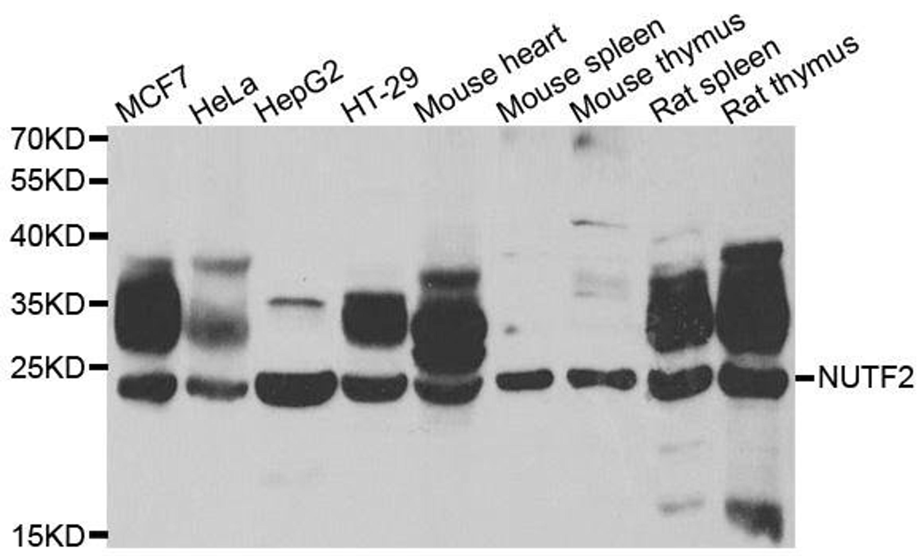 Western blot analysis of extracts of various cell lines using NUTF2 antibody