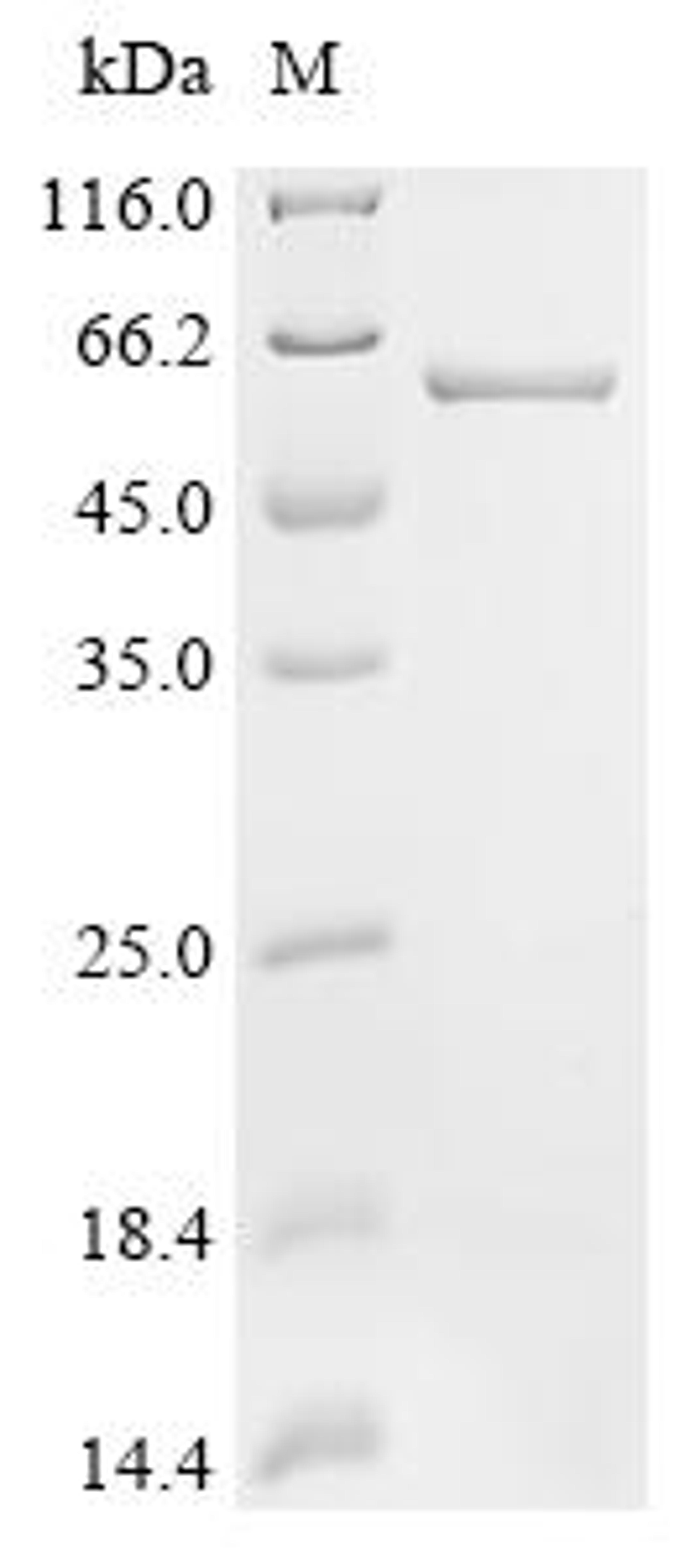 (Tris-Glycine gel) Discontinuous SDS-PAGE (reduced) with 5% enrichment gel and 15% separation gel.
