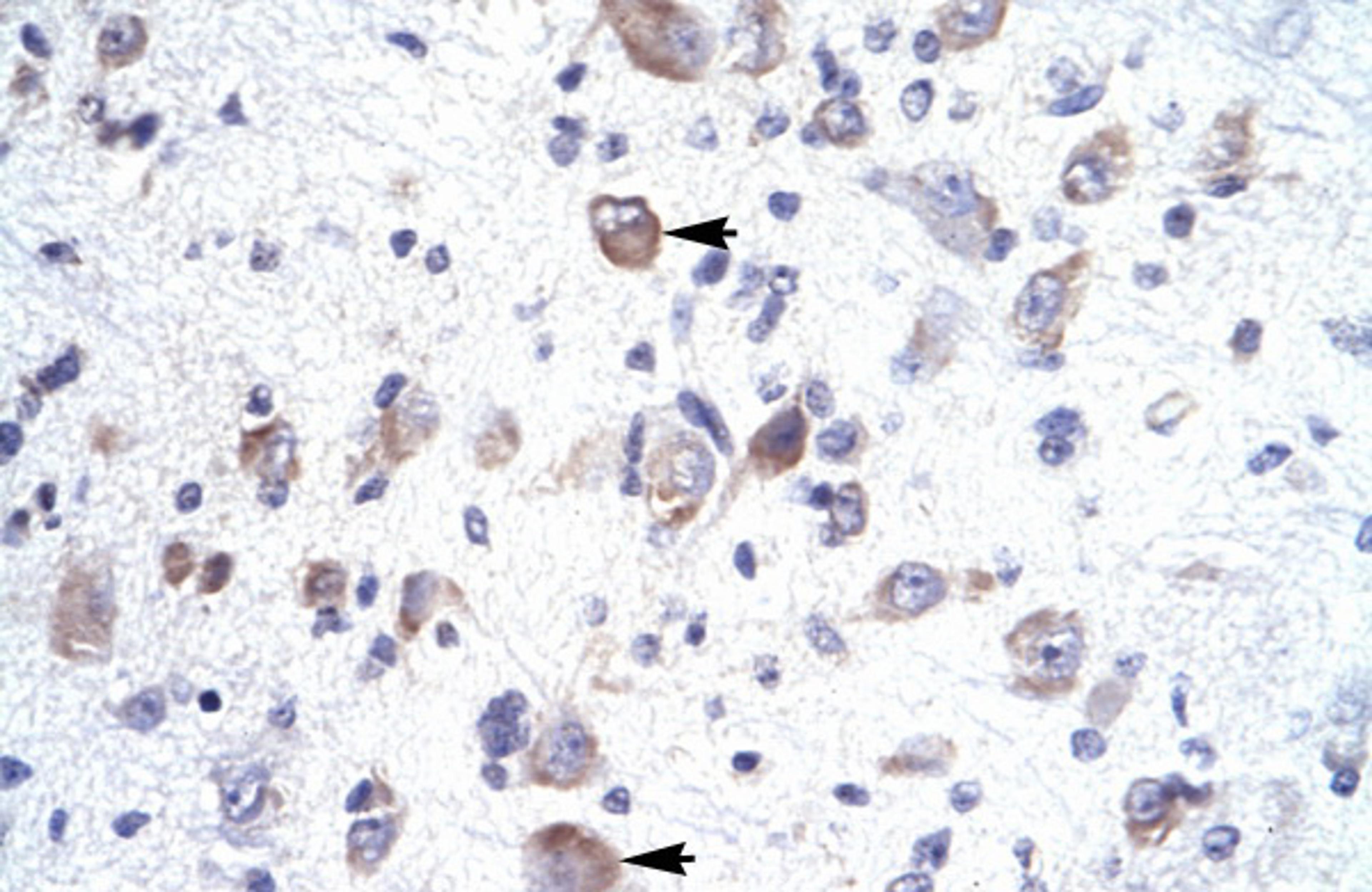 Antibody used in IHC on Human Brain.