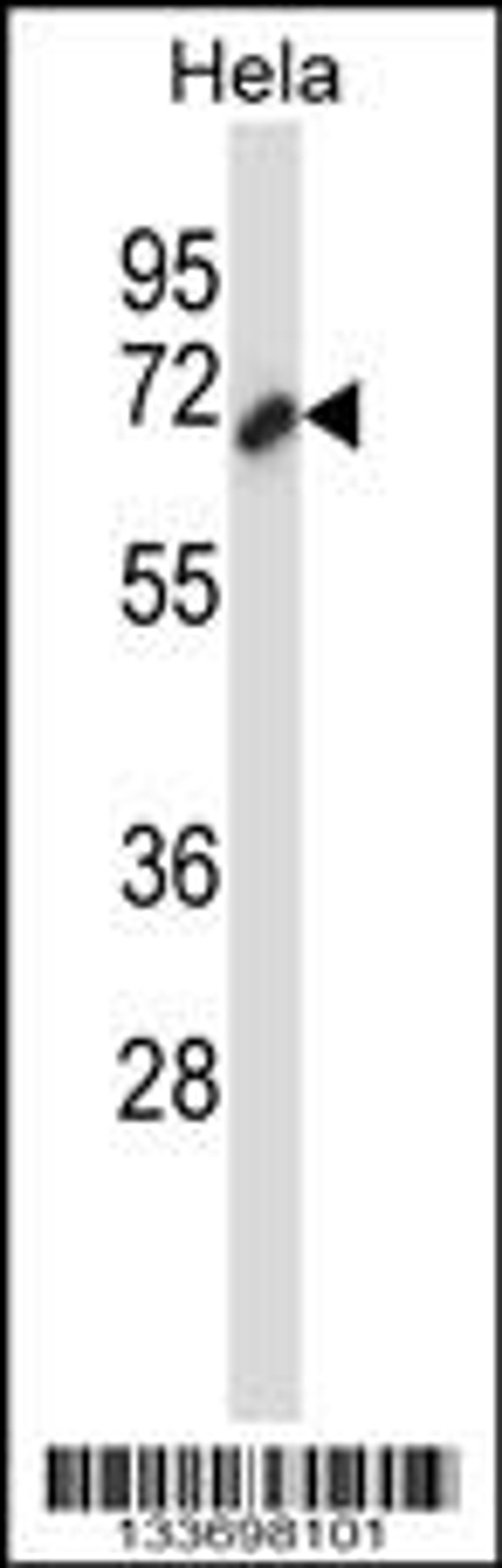 Western blot analysis in Hela cell line lysates (35ug/lane).