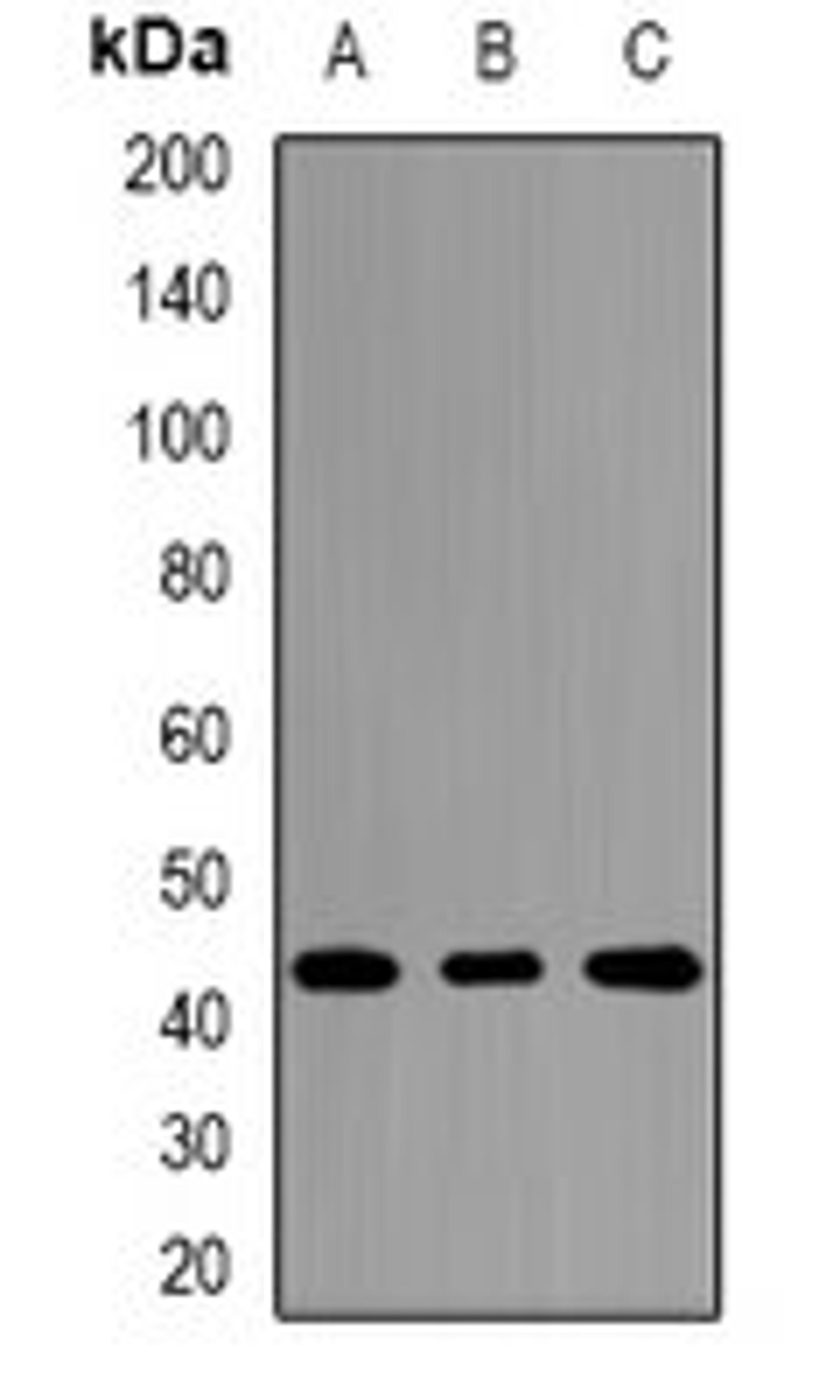 Western blot analysis of HepG2 (Lane1), Jurkat (Lane2), mouse liver (Lane3) whole cell lysates using NR2E1 antibody