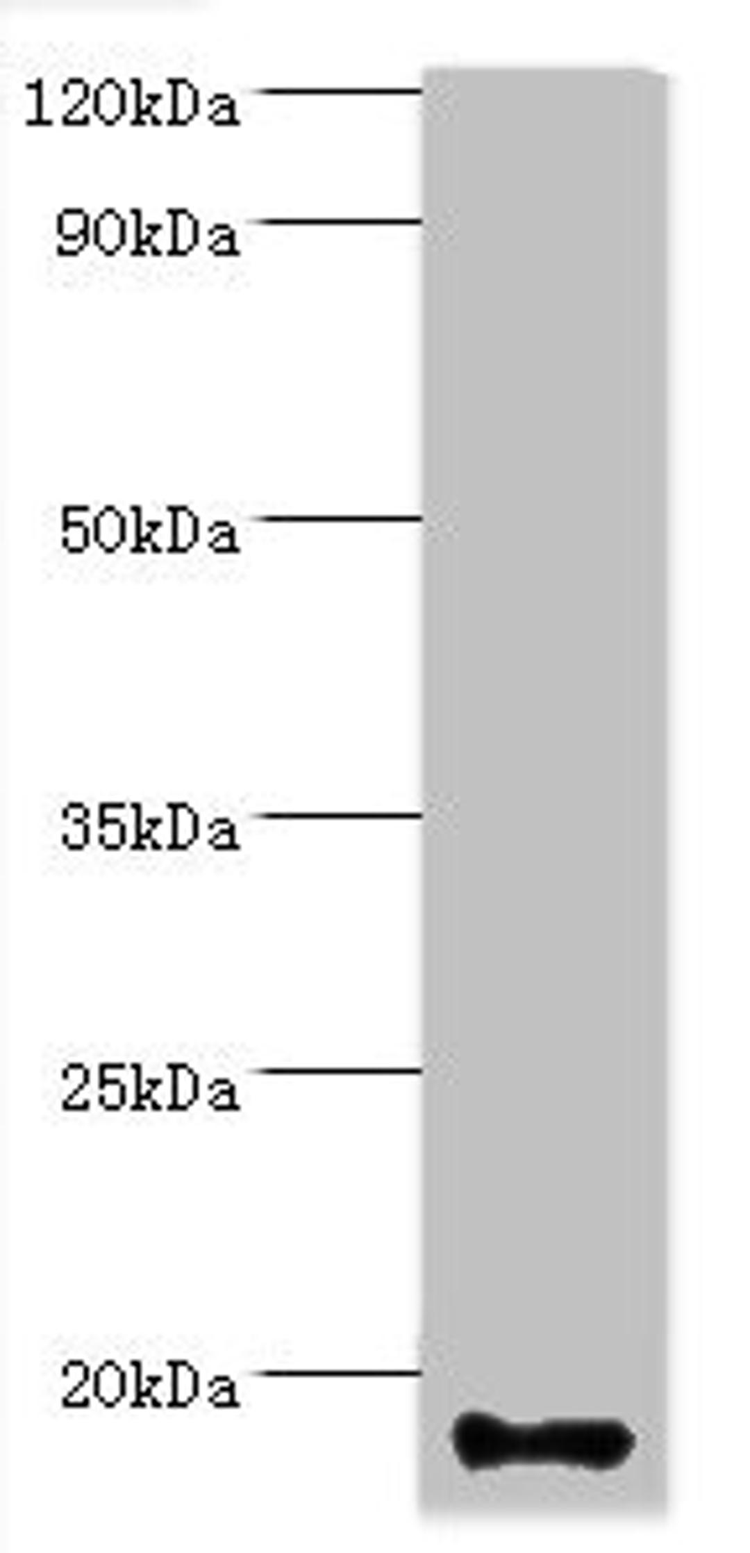 Western blot. All lanes: Calmodulin-like protein 5 antibody at 12ug/ml + A431 whole cell lysate. Secondary. Goat polyclonal to rabbit IgG at 1/10000 dilution. Predicted band size: 16 kDa. Observed band size: 16 kDa.