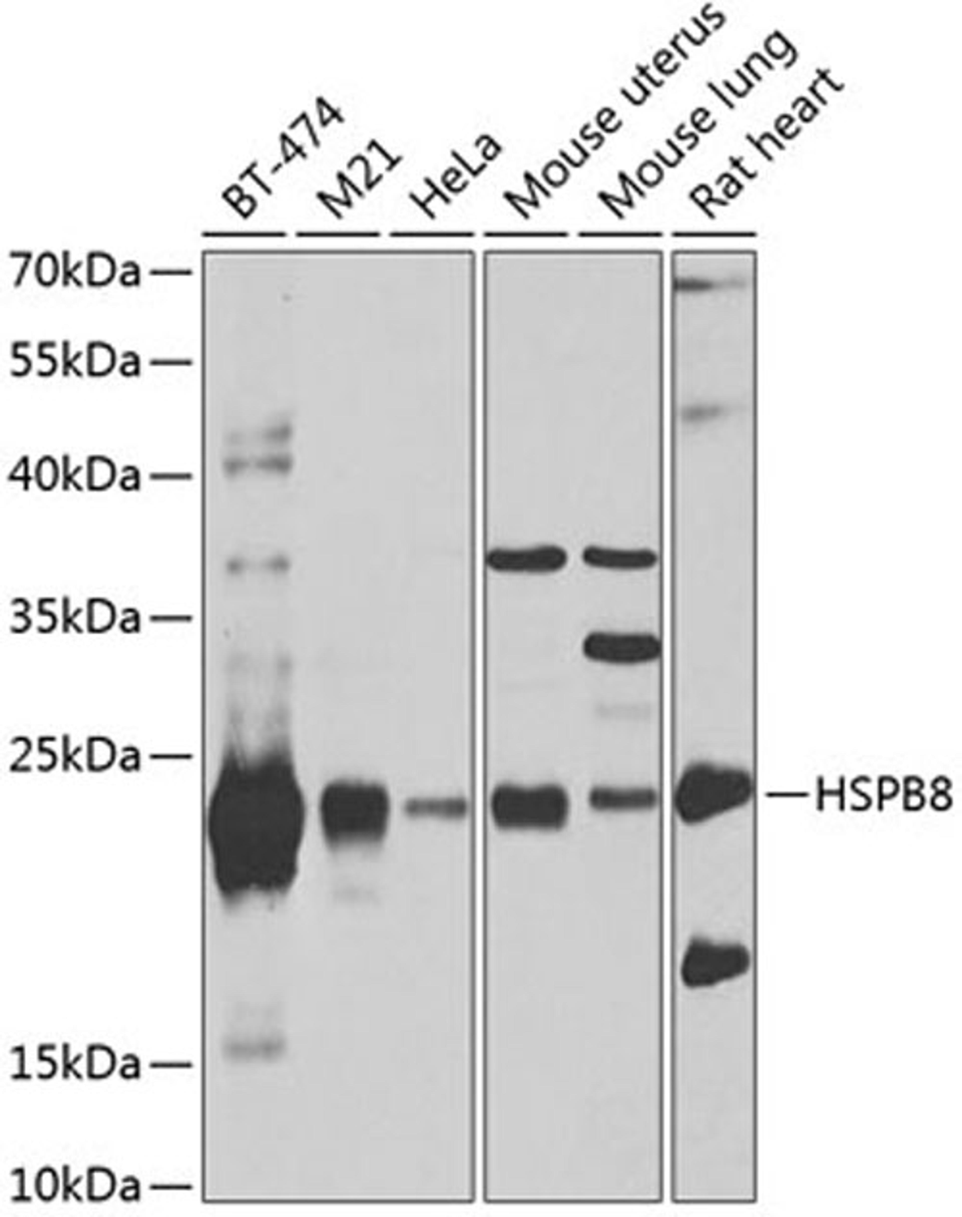 Western blot - HSPB8 antibody (A2514)