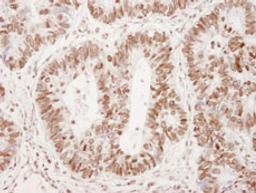 Detection of human Phospho-53BP1 (Ser 25) by immunohistochemistry.