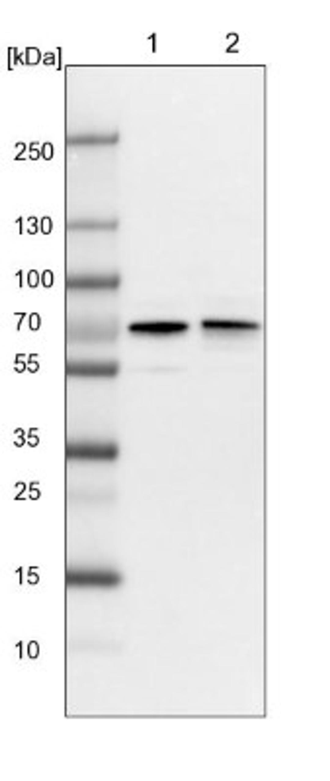 Western Blot: RIOK3 Antibody [NBP1-86982] - Lane 1: NIH-3T3 cell lysate (Mouse embryonic fibroblast cells)<br/>Lane 2: NBT-II cell lysate (Rat Wistar bladder tumour cells)