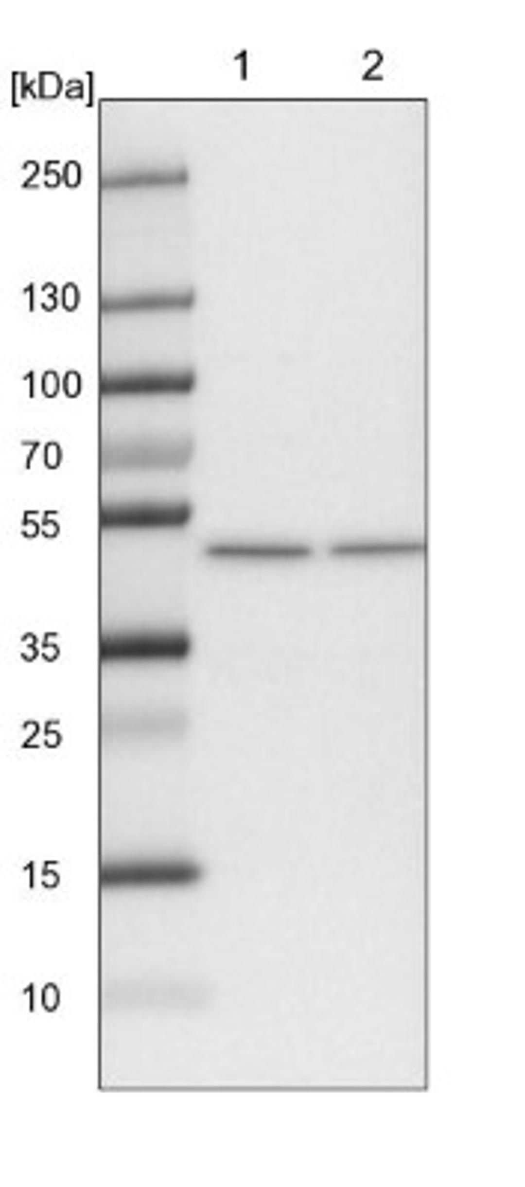 Western Blot: ELAC1 Antibody [NBP1-85337] - Lane 1: NIH-3T3 cell lysate (Mouse embryonic fibroblast cells)<br/>Lane 2: NBT-II cell lysate (Rat Wistar bladder tumour cells)