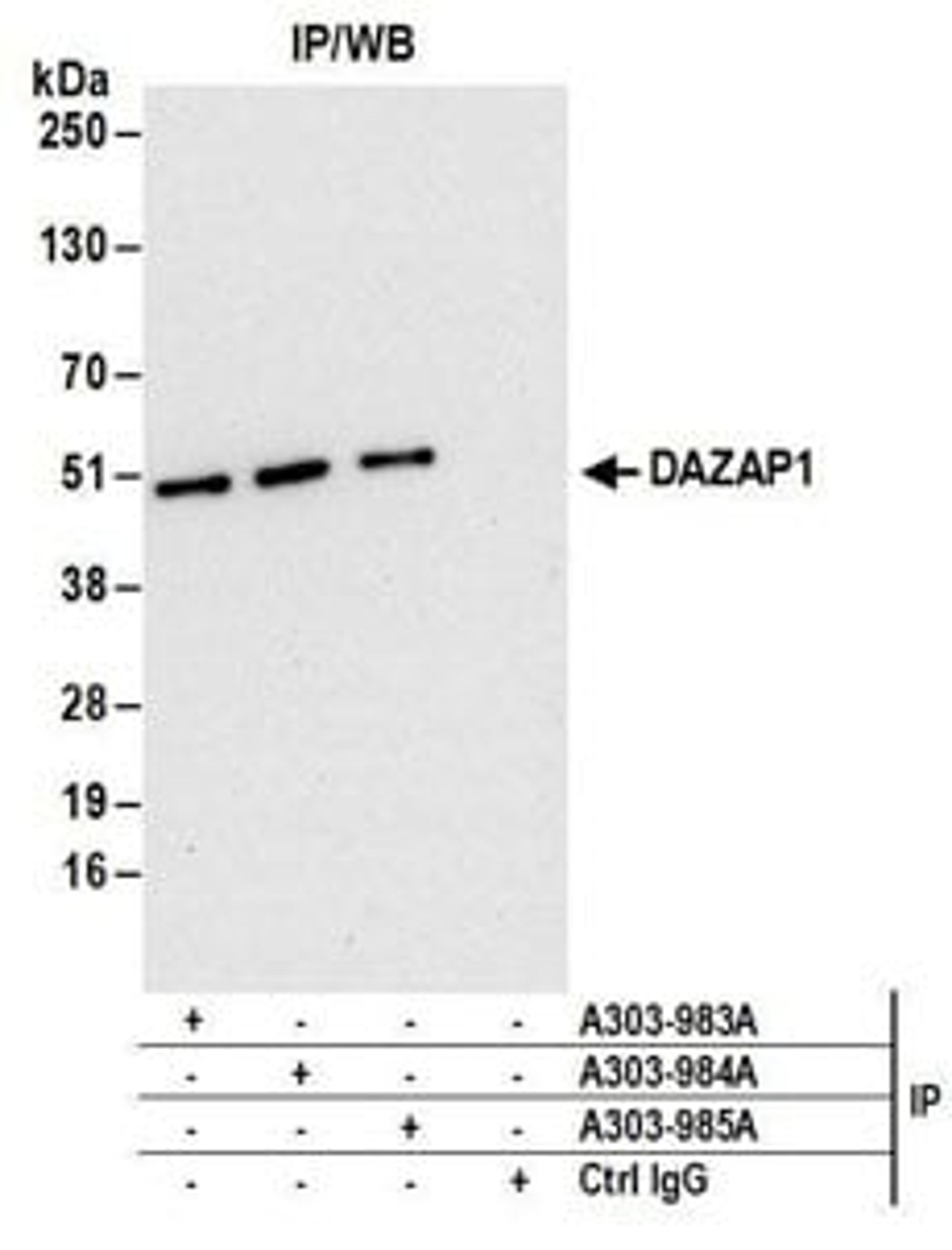 Detection of human DAZAP1 by western blot of immunoprecipitates.