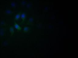 Immunofluorescence staining of A549 with CSB-RA982003A0HU at 1:60, counter-stained with DAPI. The cells were fixed in 4% formaldehyde and blocked in 10% normal Goat Serum. The cells were then incubated with the antibody overnight at 4°C. The secondary antibody was Alexa Fluor 522-congugated AffiniPure Goat Anti-Rabbit IgG(H+L).