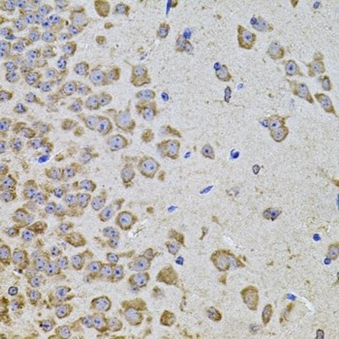 Immunohistochemistry of paraffin-embedded mouse brain tissue using PIK3CA antibody