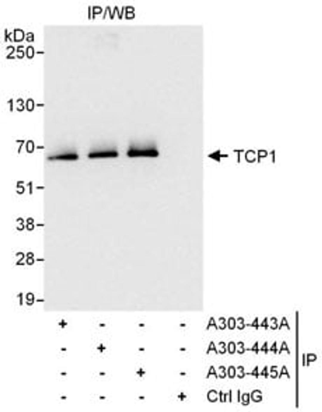 Detection of human TCP1 by western blot of immunoprecipitates.