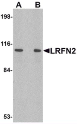Western blot analysis of LRFN2 in rat brain lysate with LRFN2 antibody at (A) 1 and (B) 2 μg/mL.