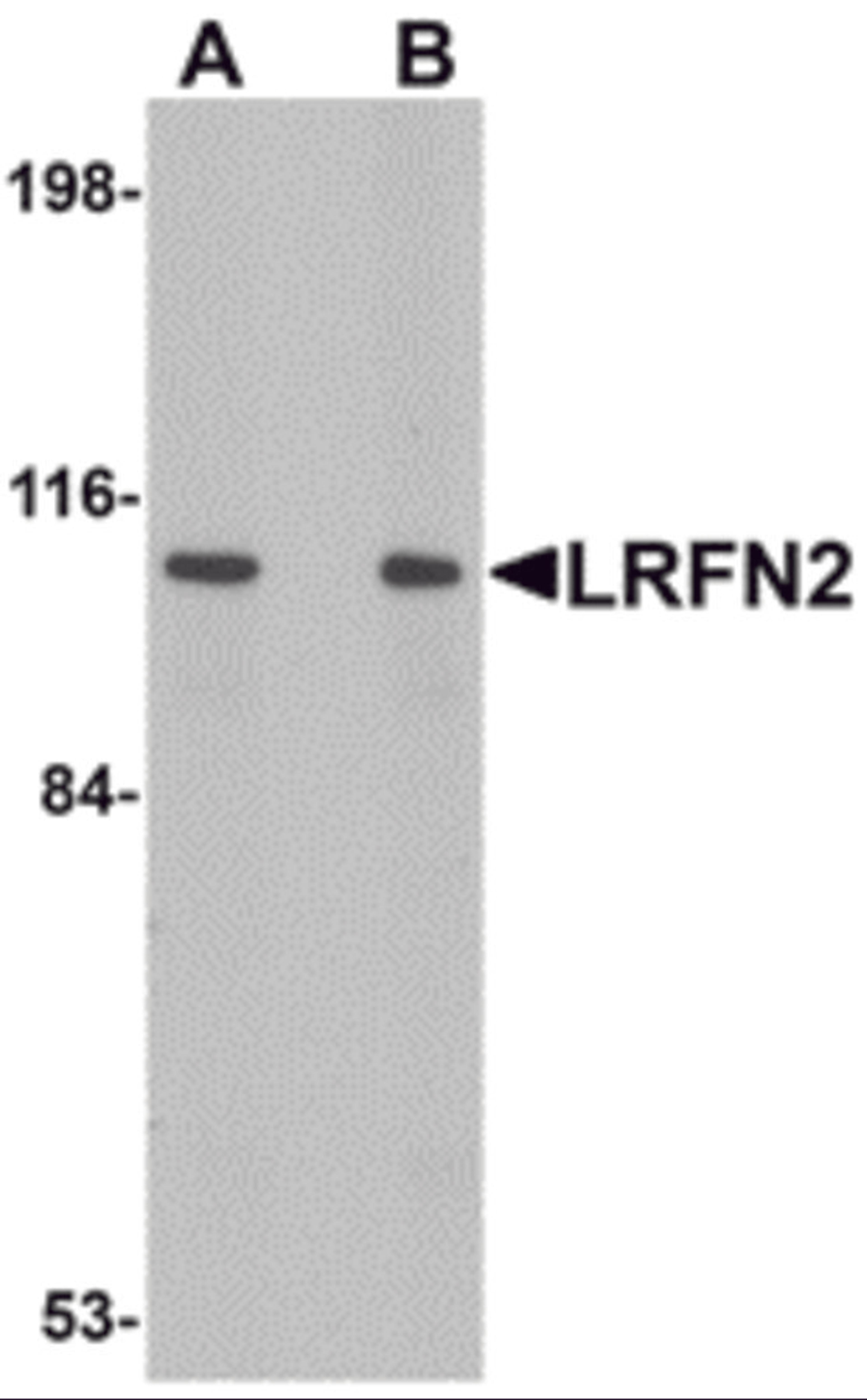 Western blot analysis of LRFN2 in rat brain lysate with LRFN2 antibody at (A) 1 and (B) 2 μg/mL.