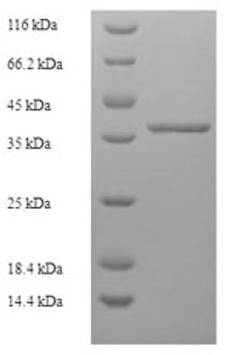 (Tris-Glycine gel) Discontinuous SDS-PAGE (reduced) with 5% enrichment gel and 15% separation gel.