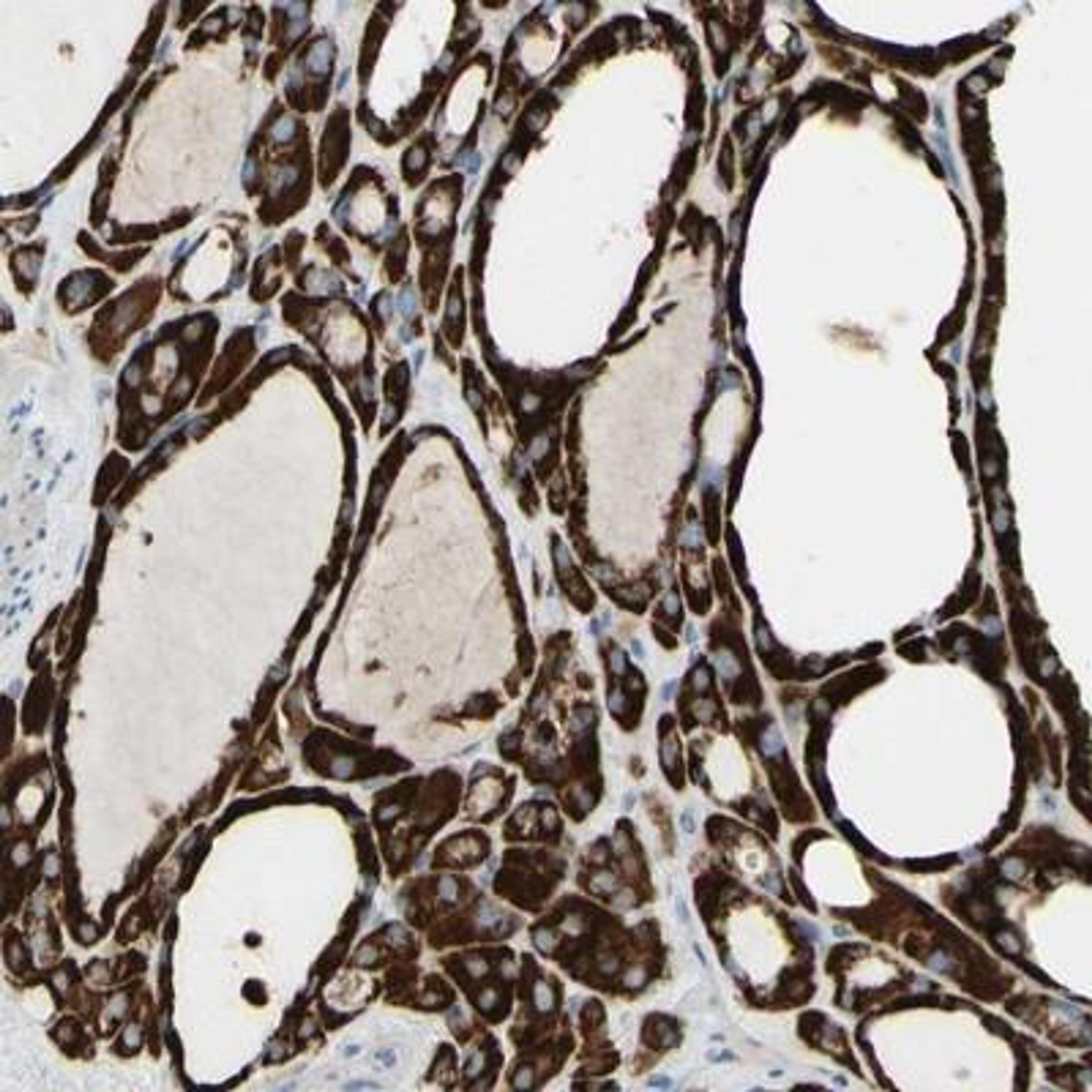 Immunohistochemistry: ACADL Antibody [NBP1-89289] - Immunohistochemical staining of human thyroid gland shows strong cytoplasmic positivity in glandular cells.