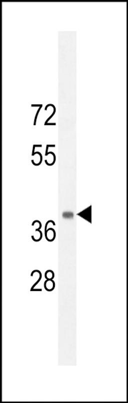 Western blot analysis in mouse kidney tissue lysates (35ug/lane).