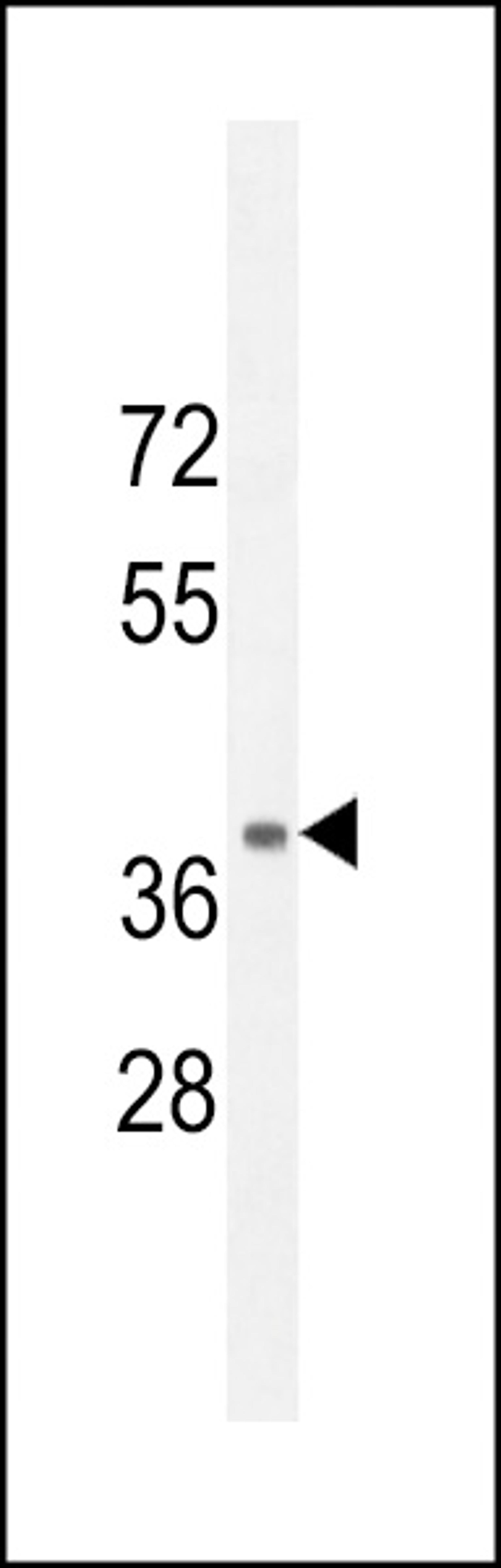 Western blot analysis in mouse kidney tissue lysates (35ug/lane).