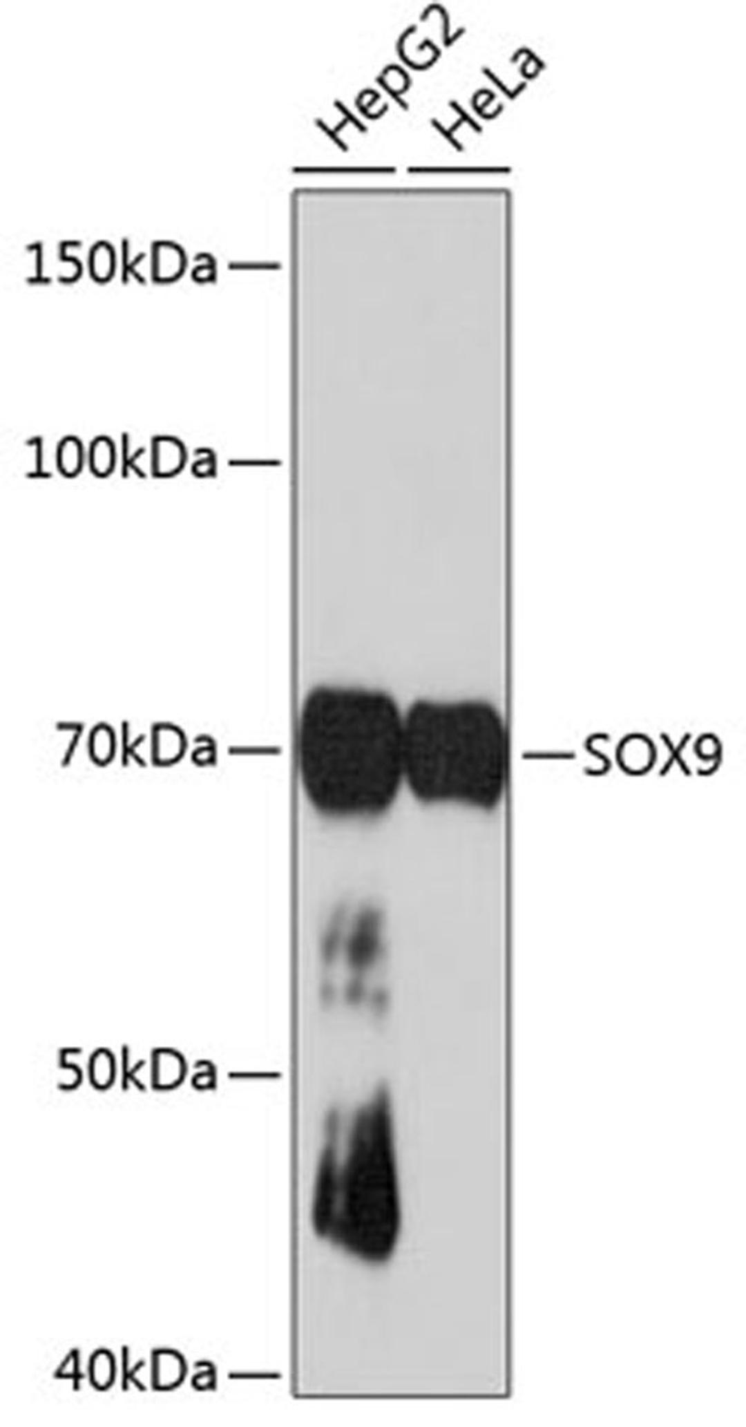 Western blot - SOX9 antibody (A19710)