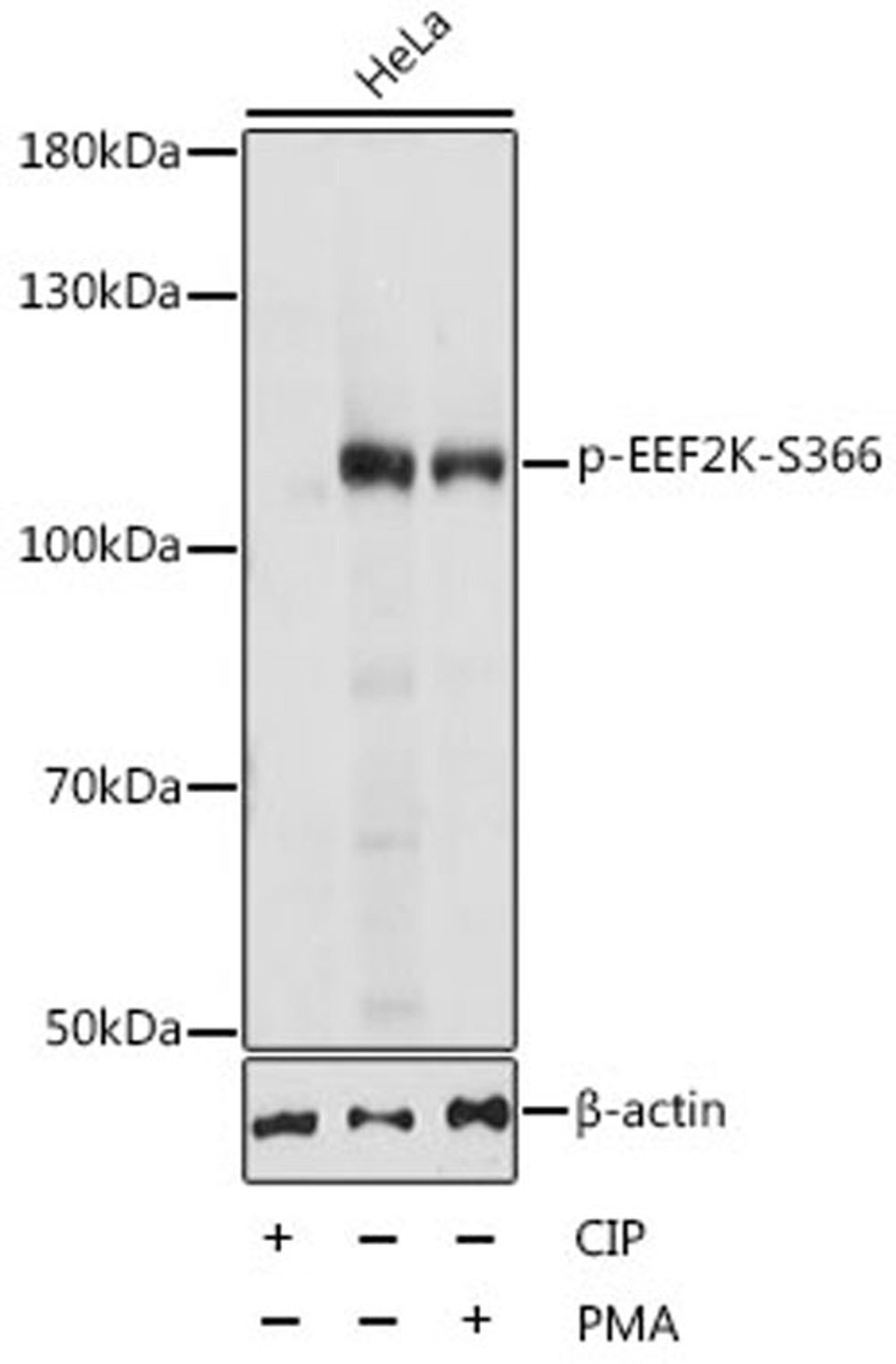 Western blot - Phospho-EEF2K-S366 antibody (AP0845)