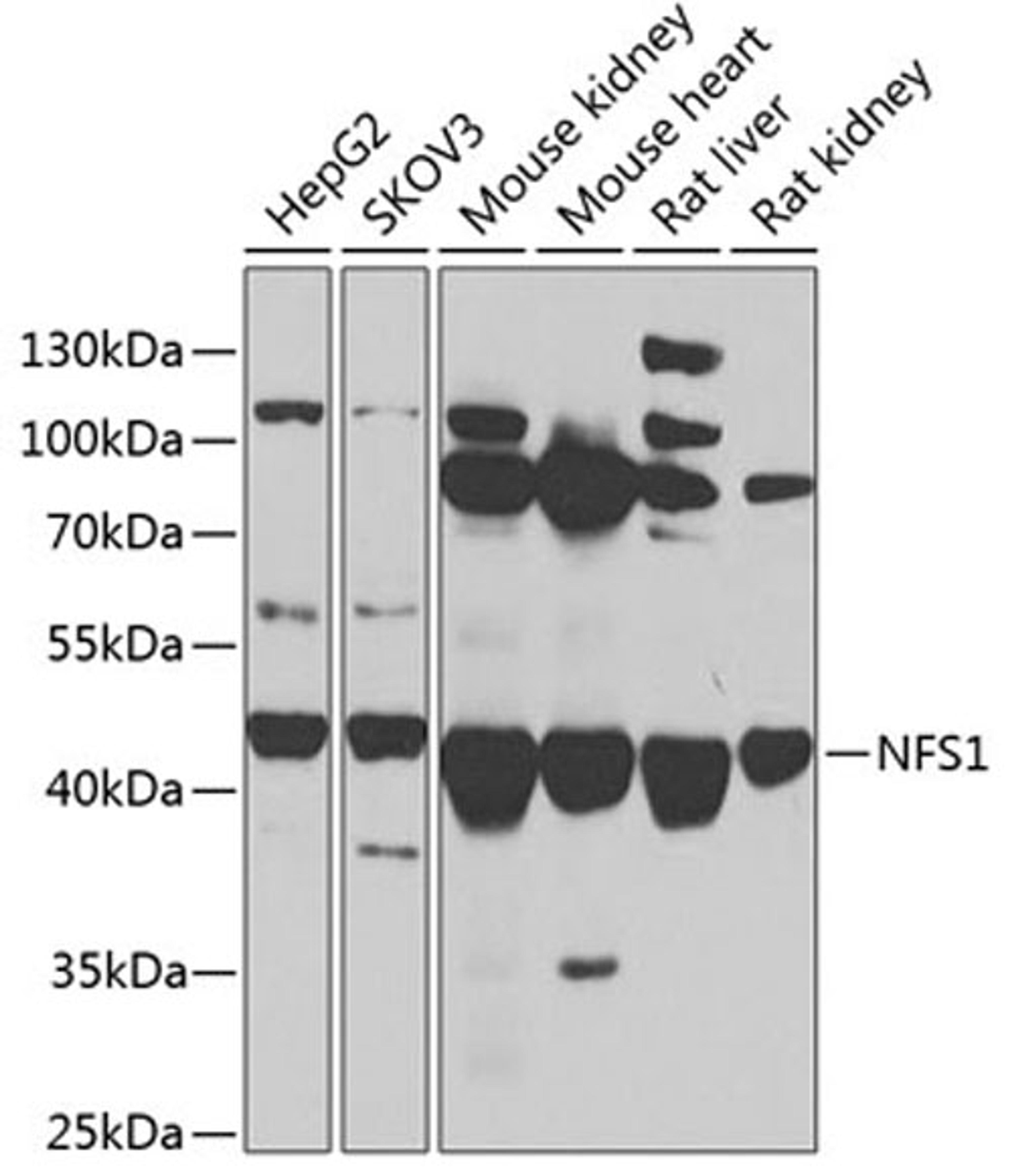 Western blot - NFS1 antibody (A13385)