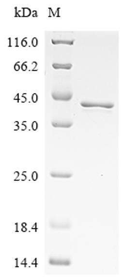 (Tris-Glycine gel) Discontinuous SDS-PAGE (reduced) with 5% enrichment gel and 15% separation gel.