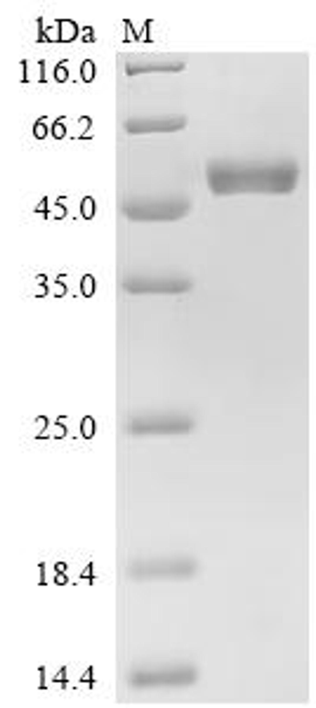 (Tris-Glycine gel) Discontinuous SDS-PAGE (reduced) with 5% enrichment gel and 15% separation gel.