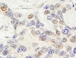 Detection of human ZNF592 by immunohistochemistry.