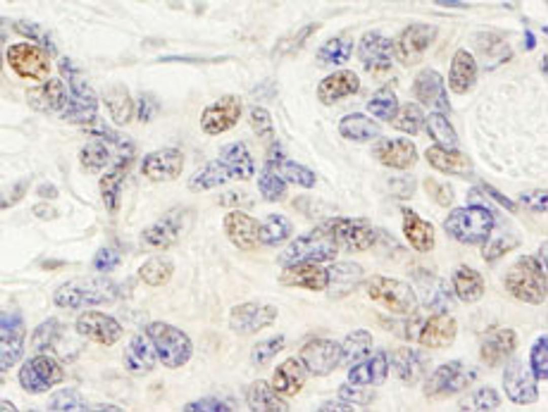 Detection of human ZNF592 by immunohistochemistry.