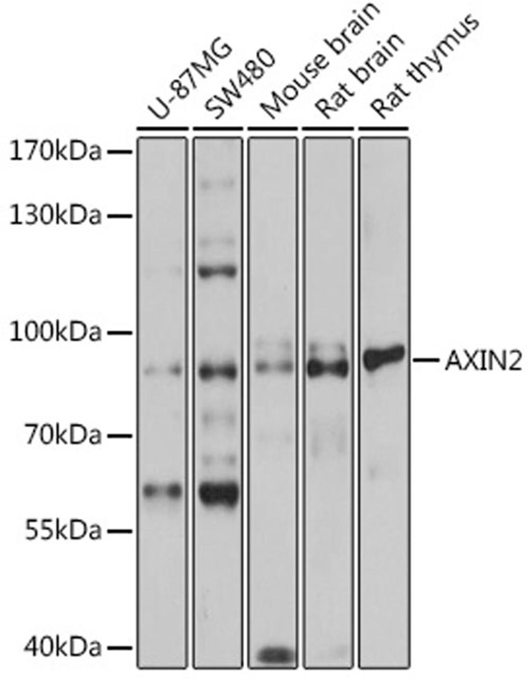 Western blot - AXIN2 antibody (A2513)