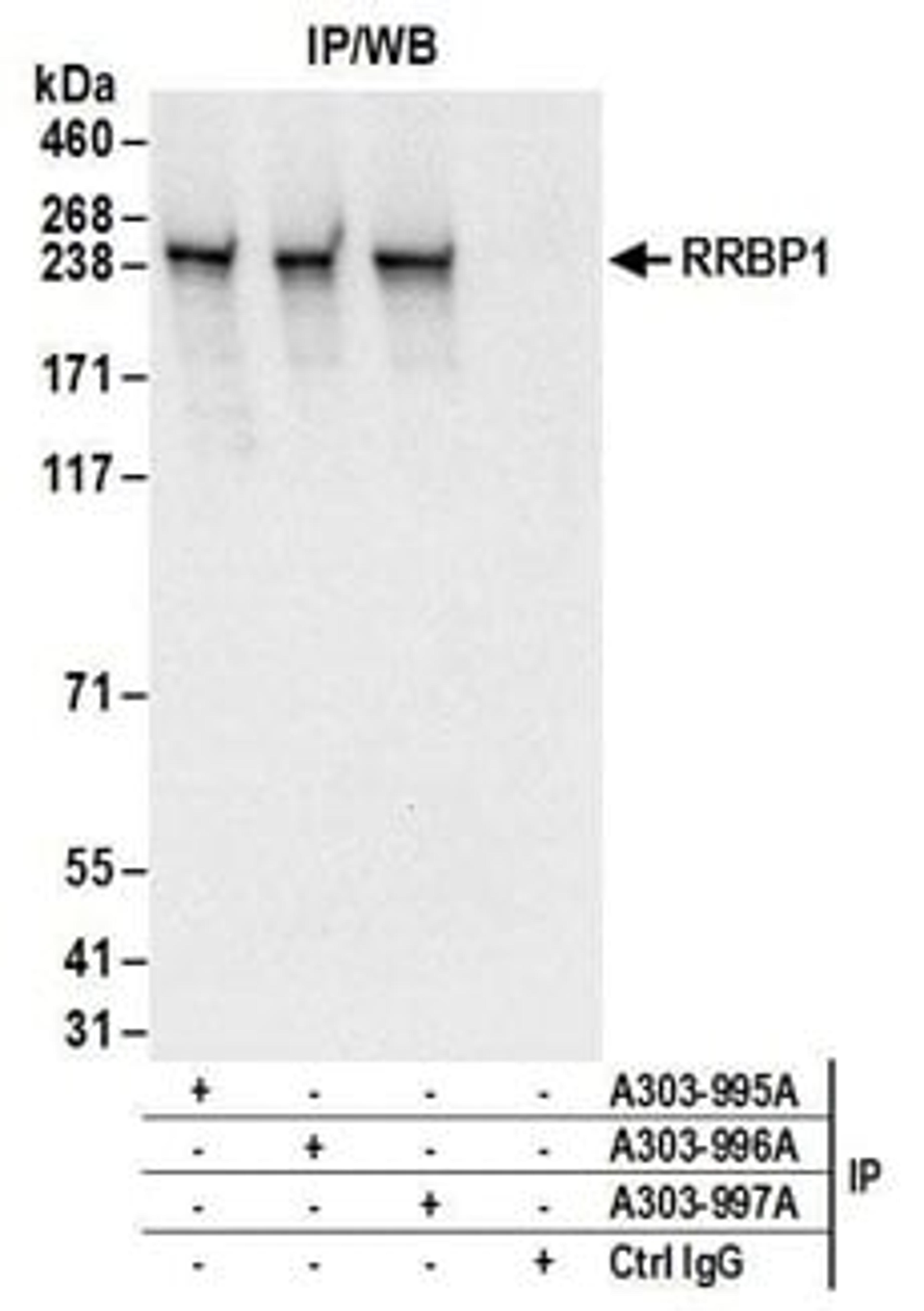 Detection of human RRBP1 by western blot of immunoprecipitates.