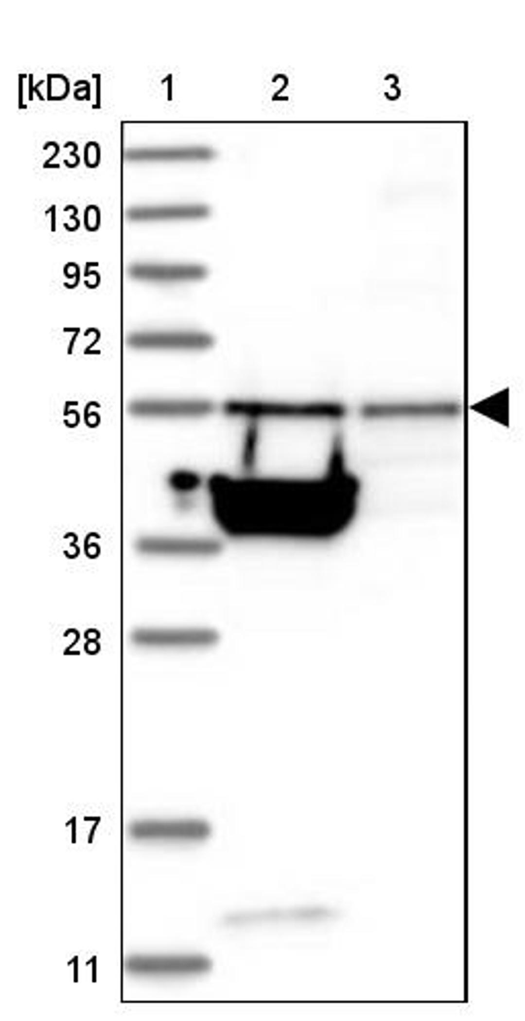 Western Blot: TSSC1 Antibody [NBP1-85927] - Lane 1: Marker [kDa] 230, 130, 95, 72, 56, 36, 28, 17, 11<br/>Lane 2: Human cell line RT-4<br/>Lane 3: Human cell line U-251MG sp