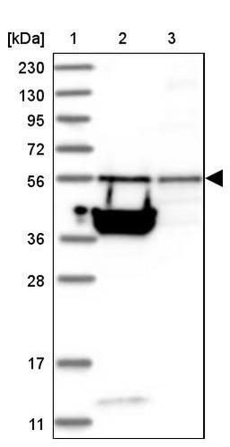 Western Blot: TSSC1 Antibody [NBP1-85927] - Lane 1: Marker [kDa] 230, 130, 95, 72, 56, 36, 28, 17, 11<br/>Lane 2: Human cell line RT-4<br/>Lane 3: Human cell line U-251MG sp