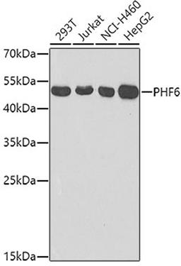 Western blot - PHF6 antibody (A7393)